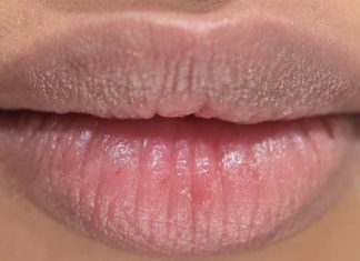 Do These To Moisturize Your Lips This Winter